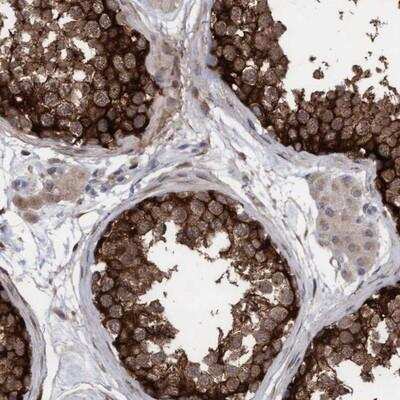Immunohistochemistry-Paraffin: Phospholipase C delta 1 Antibody [NBP1-87552]