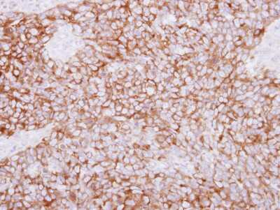 Immunohistochemistry-Paraffin: Phospholipase C delta 1 Antibody [NBP2-19810]
