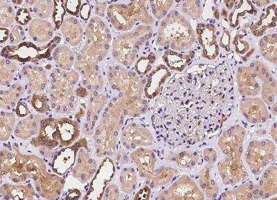 Immunohistochemistry-Paraffin: Phospholipase C delta 1 Antibody [NBP3-05935]