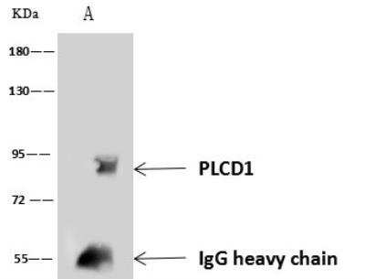 Immunoprecipitation: Phospholipase C delta 1 Antibody [NBP3-05935]