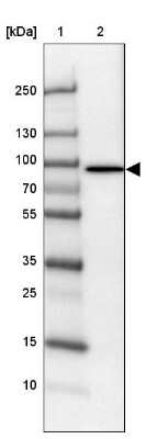 Western Blot: Phospholipase C delta 1 Antibody [NBP1-87552]