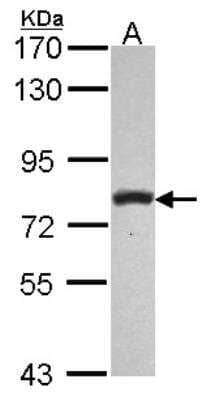 Western Blot: Phospholipase C delta 1 Antibody [NBP2-19810]