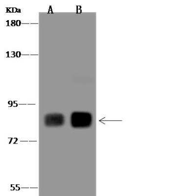 Western Blot: Phospholipase C delta 1 Antibody [NBP3-05935]