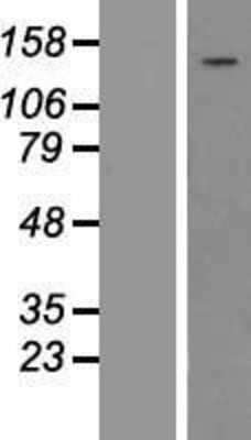 Western Blot: PLC-gamma 1 Overexpression Lysate [NBP2-10838]