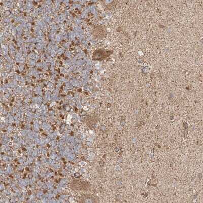 Immunohistochemistry-Paraffin: Phospholipase C like 1 Antibody [NBP1-80896]