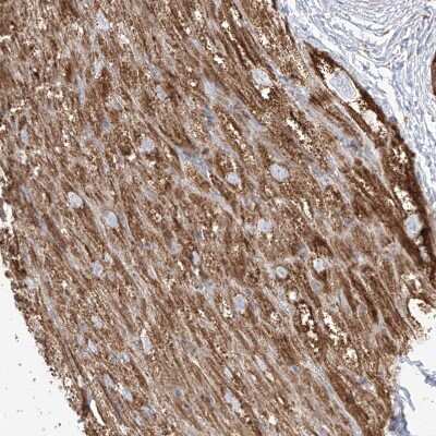 Immunohistochemistry-Paraffin: Phospholipase C like 1 Antibody [NBP1-80896]