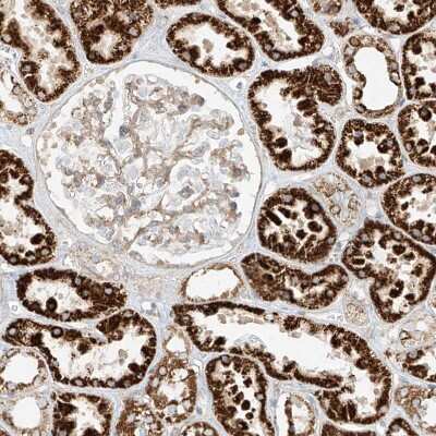 Immunohistochemistry-Paraffin: Phospholipase C like 1 Antibody [NBP1-80896]