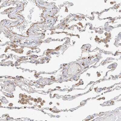 Immunohistochemistry-Paraffin: Phospholipase C like 1 Antibody [NBP1-80896]