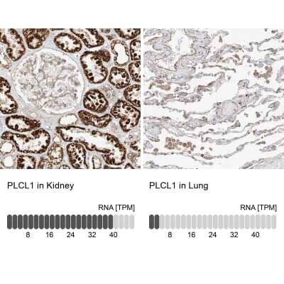 Immunohistochemistry-Paraffin: Phospholipase C like 1 Antibody [NBP1-80896]