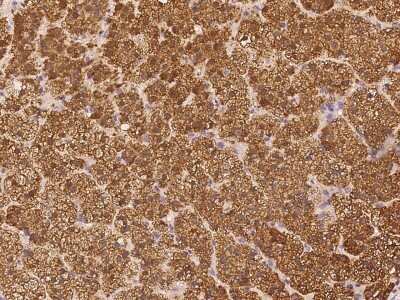 Immunohistochemistry-Paraffin: Phospholipase C like 1 Antibody [NBP3-06275]