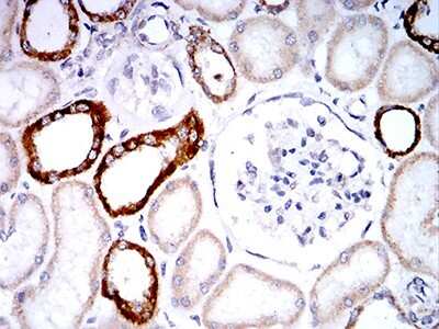 Immunohistochemistry: Phospholipase D2 Antibody (7E4D9) - BSA Free [NBP2-61784]