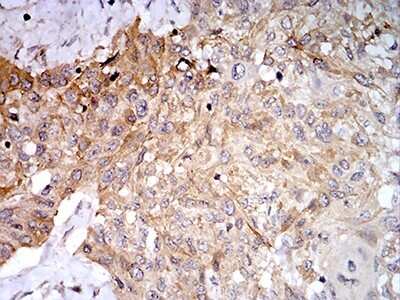 Immunohistochemistry: Phospholipase D2 Antibody (7E4D9) - BSA Free [NBP2-61784]