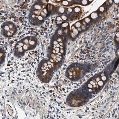 Immunohistochemistry-Paraffin: Phospholipase D2 Antibody [NBP1-87576]