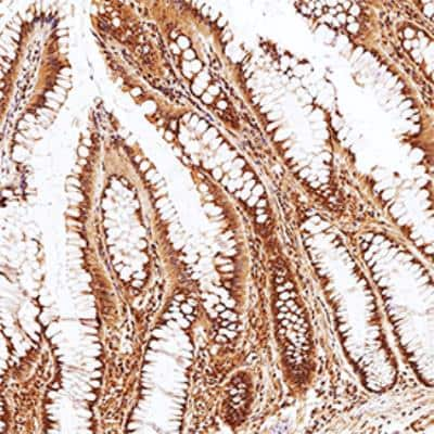 Immunohistochemistry-Paraffin: Phospholipase D2 Antibody [NBP2-23721]