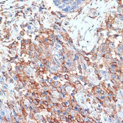 Immunohistochemistry-Paraffin: Phospholipid Scramblase 1/PLSCR1 Antibody (5U6G1) [NBP3-16183]