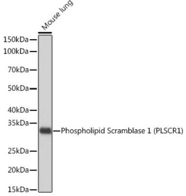 Western Blot: Phospholipid Scramblase 1/PLSCR1 Antibody (5U6G1) [NBP3-16183]
