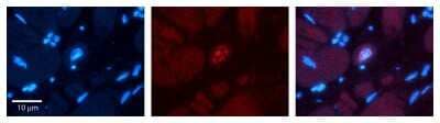 Immunohistochemistry: Phospholipid Scramblase 1/PLSCR1 Antibody [NBP1-57816]