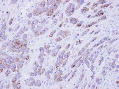 Immunohistochemistry-Paraffin: Phospholipid Scramblase 1/PLSCR1 Antibody [NBP1-32588]