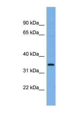 Western Blot: Phospholipid Scramblase 1/PLSCR1 Antibody [NBP1-57816]