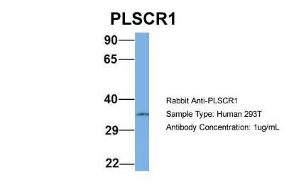 Western Blot: Phospholipid Scramblase 1/PLSCR1 Antibody [NBP1-57816]