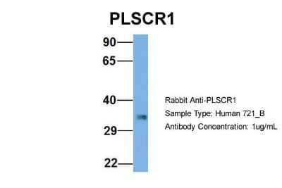 Western Blot: Phospholipid Scramblase 1/PLSCR1 Antibody [NBP1-57816]