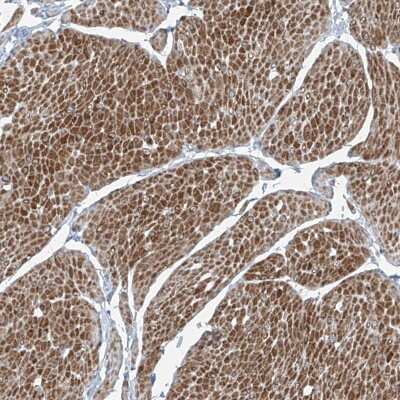 Immunohistochemistry: Phosphopantothenate-cysteine ligase Antibody [NBP2-38181]