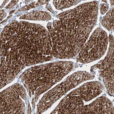 Immunohistochemistry-Paraffin: Phosphopantothenate-cysteine ligase Antibody [NBP1-87398]