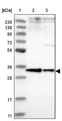 Western Blot: Phosphopantothenate-cysteine ligase Antibody [NBP1-87398]