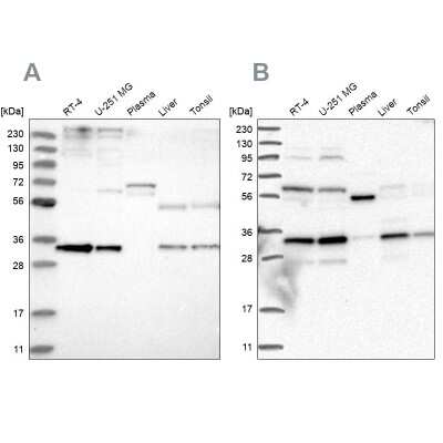 Western Blot: Phosphopantothenate-cysteine ligase Antibody [NBP1-87398]