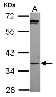 Western Blot: Phosphopantothenate-cysteine ligase Antibody [NBP2-19811]