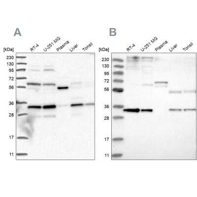 Western Blot: Phosphopantothenate-cysteine ligase Antibody [NBP2-38181]