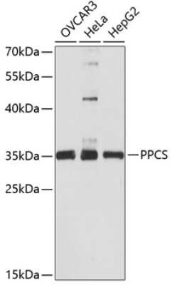 Western Blot: Phosphopantothenate-cysteine ligase AntibodyAzide and BSA Free [NBP2-93406]