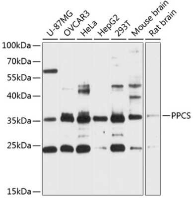 Western Blot: Phosphopantothenate-cysteine ligase AntibodyAzide and BSA Free [NBP2-93408]