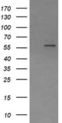 Western Blot: Phosphoribosyl Pyrophosphate Amidotransferase Antibody (OTI1B11) [NBP2-45379]