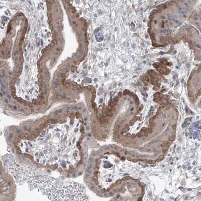 Immunohistochemistry-Paraffin: Phosphoribosyl Pyrophosphate Amidotransferase Antibody [NBP1-89744]