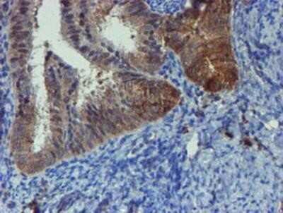 Immunohistochemistry-Paraffin: Phosphoribosyl Pyrophosphate Amidotransferase Antibody (OTI1B8) [NBP2-02056]