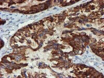 Immunohistochemistry-Paraffin: Phosphoribosyl Pyrophosphate Amidotransferase Antibody (OTI1B8) [NBP2-02056]