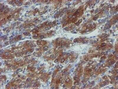 Immunohistochemistry-Paraffin: Phosphoribosyl Pyrophosphate Amidotransferase Antibody (OTI1B8) [NBP2-02056]