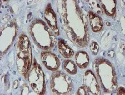 Immunohistochemistry-Paraffin: Phosphoribosyl Pyrophosphate Amidotransferase Antibody (OTI1B8) [NBP2-02056]