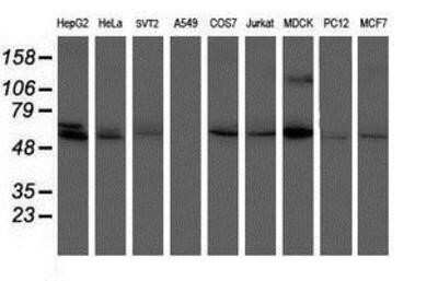 Western Blot: Phosphoribosyl Pyrophosphate Amidotransferase Antibody (OTI1B8) [NBP2-02056]