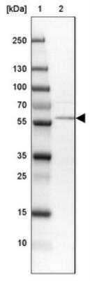 Western Blot: Phosphoribosyl Pyrophosphate Amidotransferase Antibody [NBP1-89744]