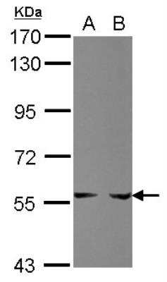 Western Blot: Phosphoribosyl Pyrophosphate Amidotransferase Antibody [NBP2-19812]