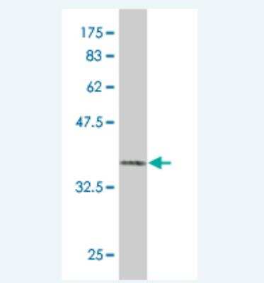 Western Blot: Phosphorylase B Antibody (2E9) [H00005257-M02]