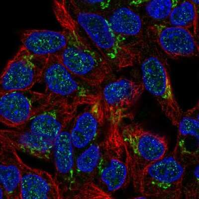 Immunocytochemistry/ Immunofluorescence: Phosphorylase B Antibody [NBP2-57900]