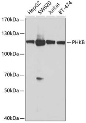 Western Blot: Phosphorylase B AntibodyBSA Free [NBP2-93725]