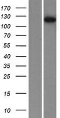 Western Blot: Phosphorylase B Overexpression Lysate [NBP2-10607]