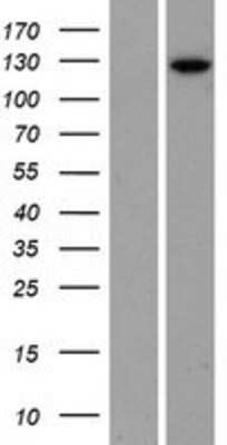 Western Blot: Phosphorylase B Overexpression Lysate [NBP2-11145]