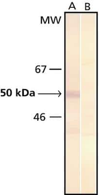 Western Blot: Phosphoserine Antibody (PSR-45) [NB600-405]