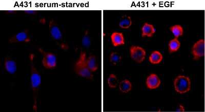 Immunocytochemistry/ Immunofluorescence: Phospho-Tyrosine Antibody (RM111) [NBP2-77400]
