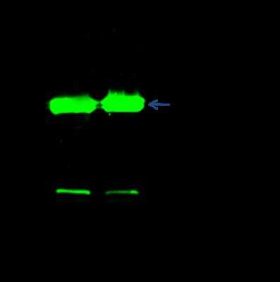 Immunoprecipitation: Phosphoserine phosphatase Antibody (001) [NBP2-90222]